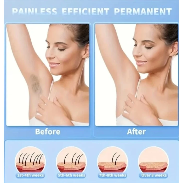 Эпилятор Gertzy Lady Shaver mg309