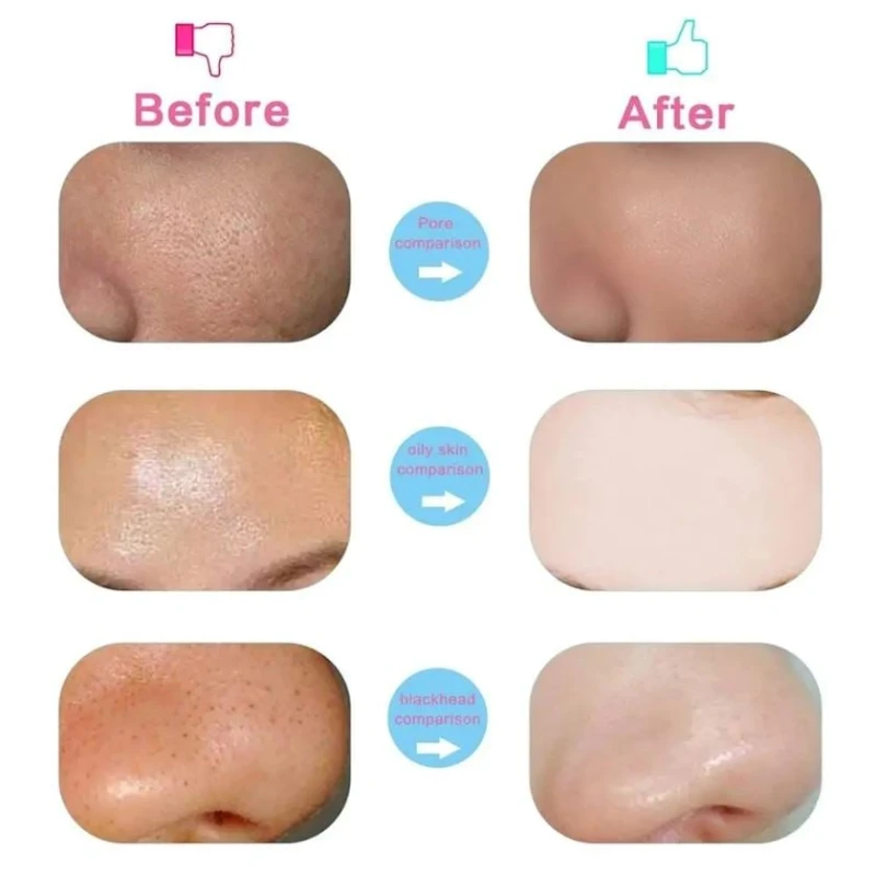 Электрический прибор для очищения 5 в 1 Ukliss WT-221 Электрический прибор для очищения 5 в 1 Ukliss WT-221