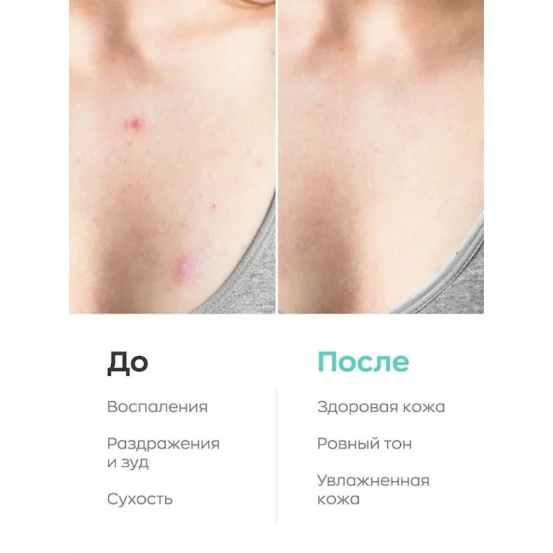 Duş geli Likato professional Soft skin həssas dəri üçün 250 ml