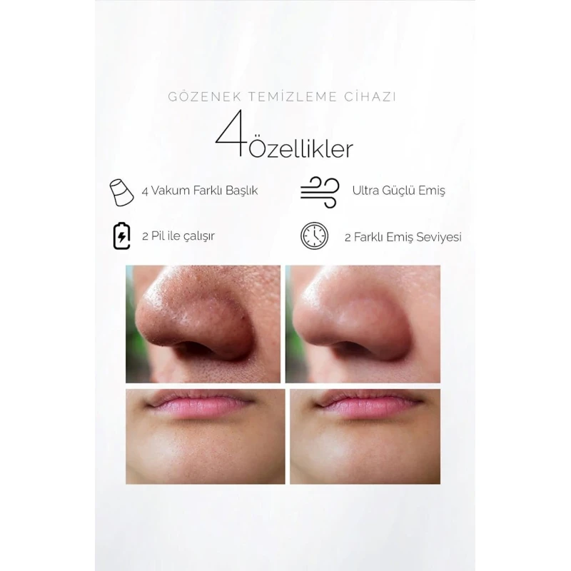 Вакуумный очиститель пор Dempower Dp-09 Вакуумный очиститель пор Dempower Dp-09